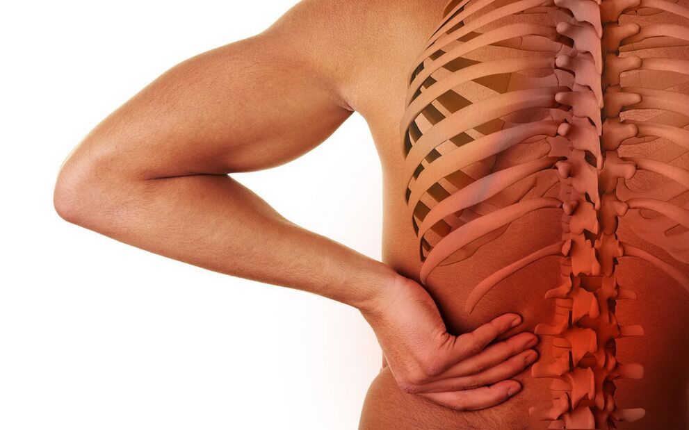 muguras sāpes osteohondrozes dēļ