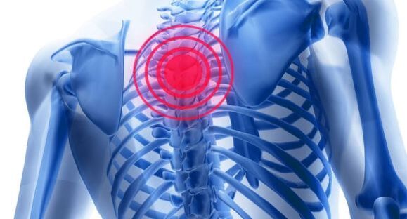 Krūšu mugurkaula osteohondrozes ārstēšana