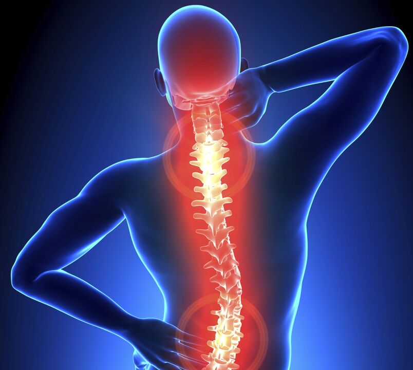 Mugurkaula osteohondroze