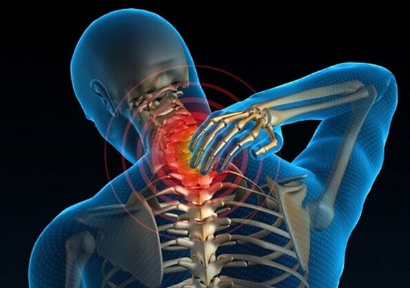 kakla sāpes osteohondrozes dēļ