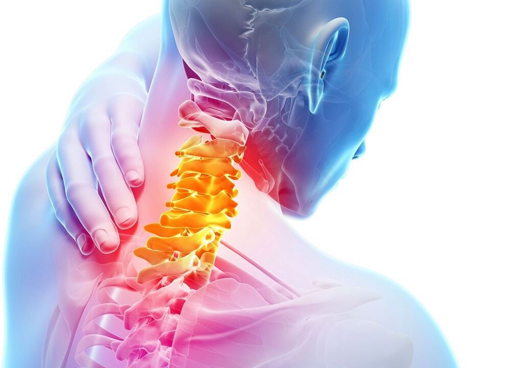 osteohondrozes lokalizācija
